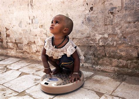 Govt to launch drive for Severely Acute Malnourished children - Hello ...