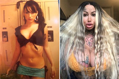 Fetish model, 24, nearly died after designer vagina op surgery in $100k ...