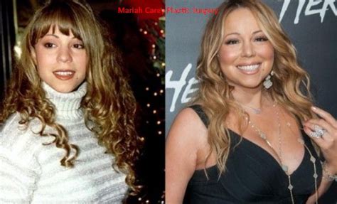 UPDATED! Mariah Carey Plastic Surgery Before After 2022