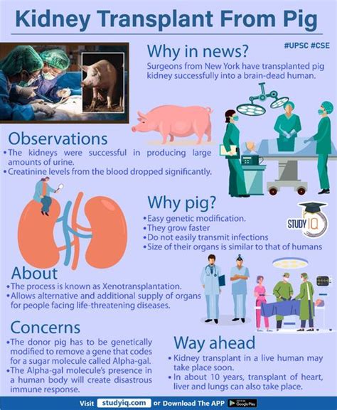 Kidney Transplant From Pig : r/UPSCpreparation