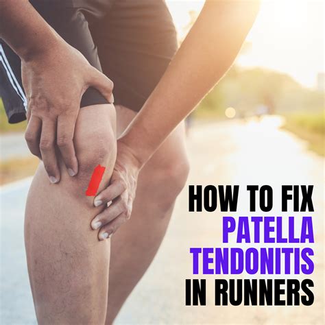 Patellar Tendonitis In Runners Symptoms Causes And Treatment Options | SexiezPicz Web Porn