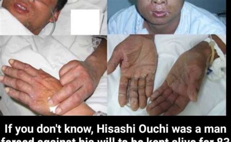 The 83 Day Death Of Hisashi Ouchi – Otosection