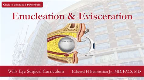 Enucleation & Evisceration - Wills Eye Library