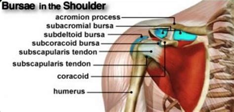 PART 5: SHOULDER SERIES – 5 MOST COMMON DIAGNOSIS [SHOULDER BURSITIS] - Back & Joint Rehab ...