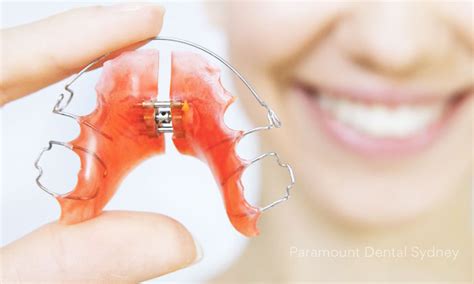 Removable Dental Appliances & Retainers | Paramount Dental — Paramount Dental Sydney