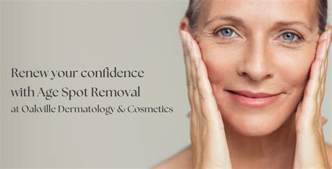 Age Spot Removal | Oakville Dermatology | Medical, Surgical & Cosmetic ...