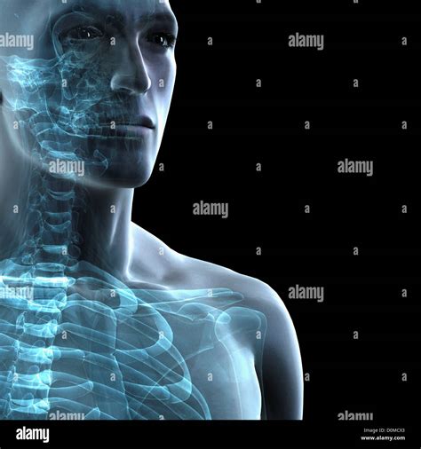 X-Ray image showing the bones of the neck Stock Photo - Alamy