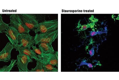 Cleaved Caspase-3 (Asp175) (D3E9) Rabbit mAb (Alexa Fluor® 647 ...