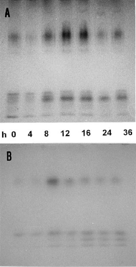 Induction of peroxidase (POD) isozymes in elicited root tissue of A,... | Download Scientific ...