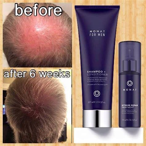 Amazing Monat Before & Afters!! - My Life in the Sun