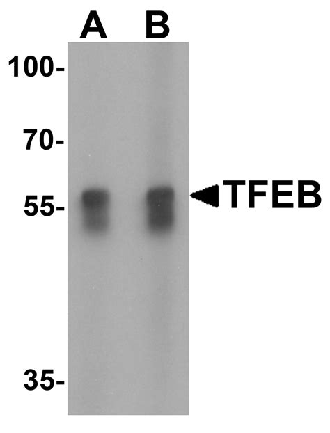 TFEB Antibody - SAB | Signalway Antibody