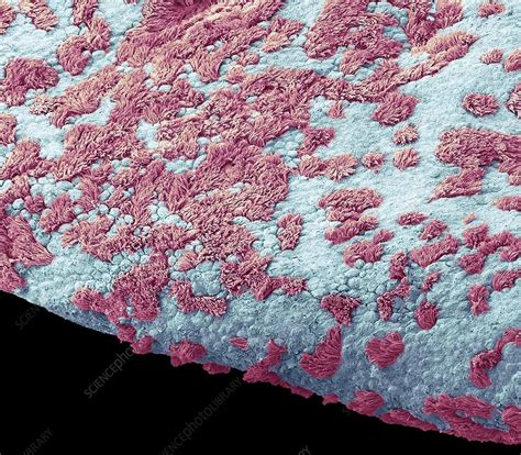 Fimbriae of a fallopian tube, SEM - Stock Image - C024/6426 - Science Photo Library