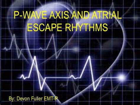 P wave axis and escape rhythms