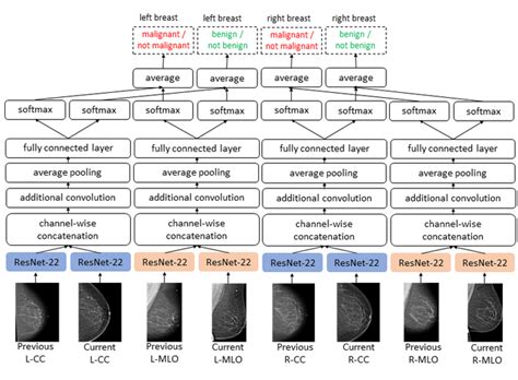 Screening Mammogram Classification with Prior Exams | JP