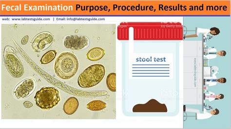 Fecal Examination Procedures - Lab Tests Guide