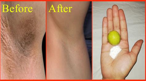 Remove Darkness Of Underarms Instantly Permanently | Home Remedy ...