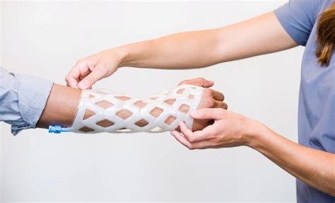 Una nueva y revolucionaria escayola para el brazo es impermeable, transpirable y no pica | Tea Band