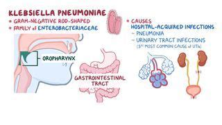 Nosocomial Infection: What Is It, Causes, Prevention, and More | Osmosis