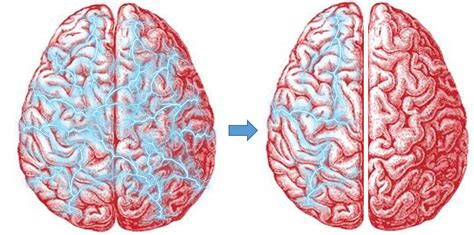 Learn a Thing Today: The Prisoner Inside Your Skull