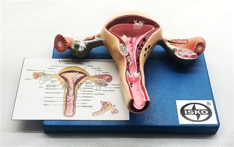 Buy ISKO Uterus And Ovary Model Female Reproductive Organ Model Human ...