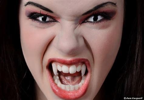 Vampire Fangs : r/vampirefangs