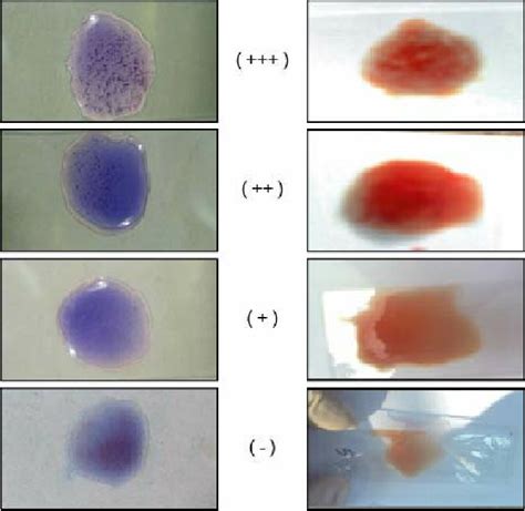 Slide Agglutination Test Procedure