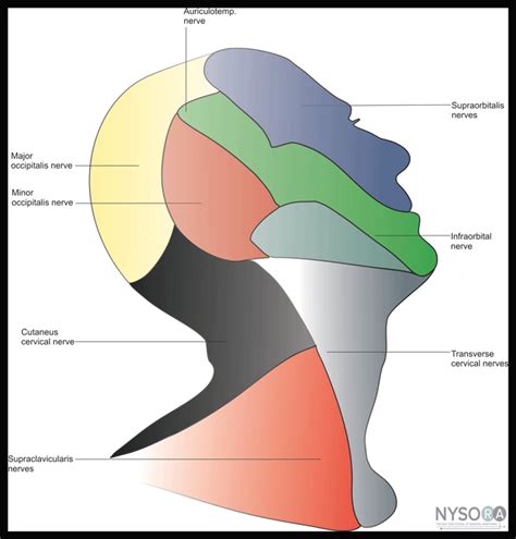 Ultrasound-Guided Superficial Cervical Plexus Block - NYSORA The New ...