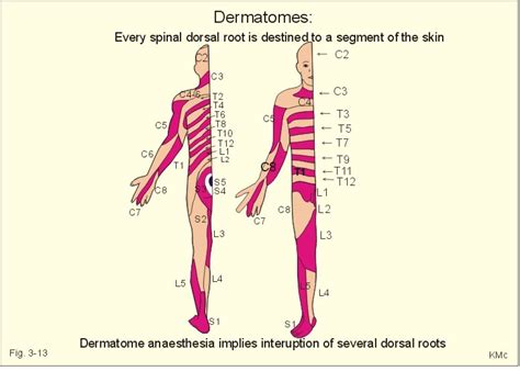 Dermatome Map Shingles Leg