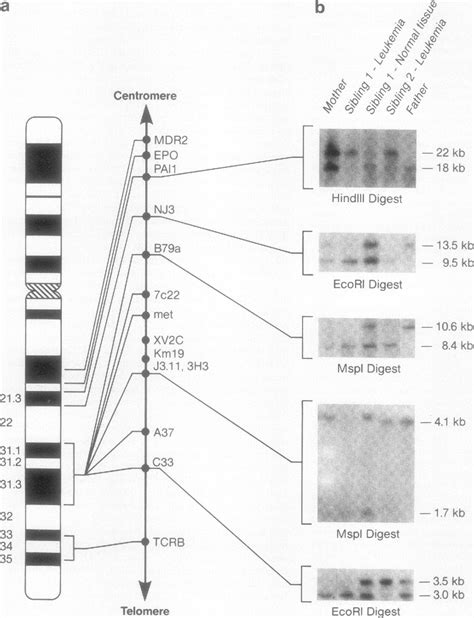 Figure 1 from Familial bone marrow monosomy 7. Evidence that the ...