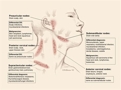 Postauricular Lymphadenopathy