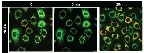 JC-1 - Mitochondrial Membrane Potential Assay Kit (ab113850) | Abcam