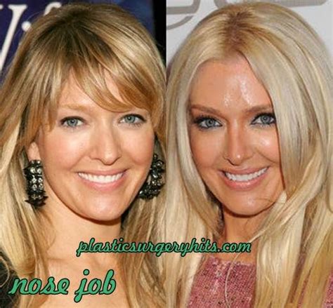 Erika Jayne before surgery #rhobh | Erika jayne, Nose job, Plastic surgery