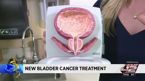 Video: One-time chemotherapy treatment drops bladder cancer recurrence ...