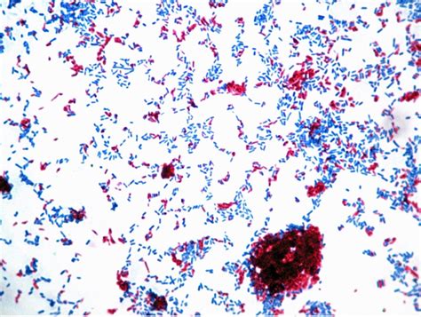 ACID-FAST STAIN – Red Mountain Microbiology