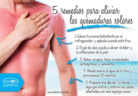 5 remedios para las quemaduras solares | Infografías y Remedios