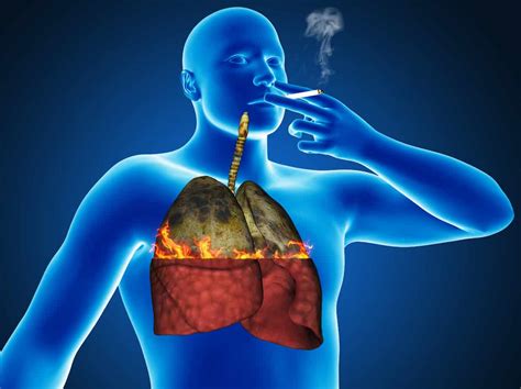 Smokers Or Past Smokers: Six Ways To Cleanse And Revitalize Your Lungs ...