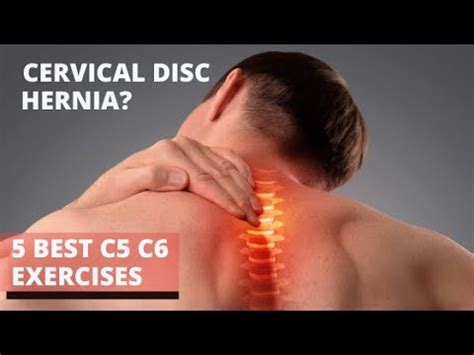 4 Best Cervical Disc Herniation Exercises| c5 c6 neck pain exercises ...