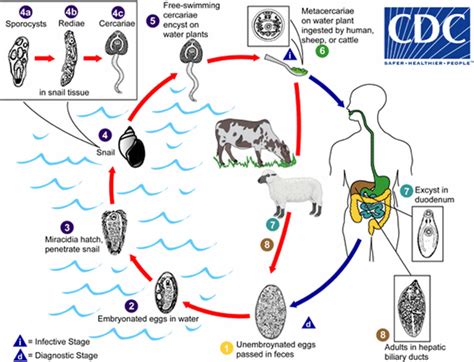 Human liver fluke infection, liver fluke life cycle, symptoms & treatment