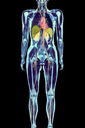 Full Body Scan, MRI Scan Photographic Print by Volker Steger - AllPosters.co.uk