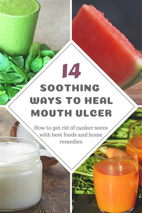 14 Soothing Home Remedies & Best Foods to Heal Mouth Ulcer