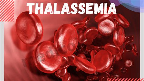 What is Thalassemia ? & Details of 2 Types of Thalassemia.