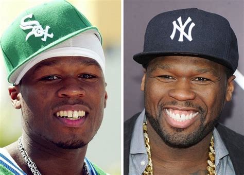 Top 15 celebrities with bad teeth in 2021 (with pictures) - Tuko.co.ke