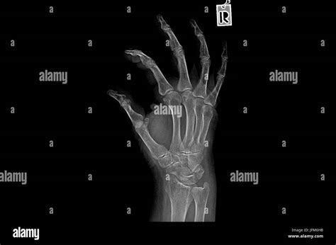 Human knuckle hi-res stock photography and images - Alamy