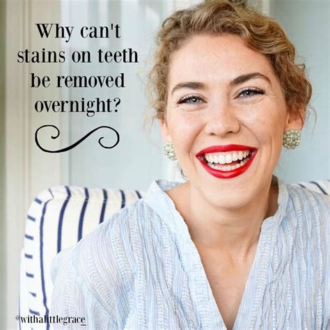 Pin on Science of Teeth Whitening