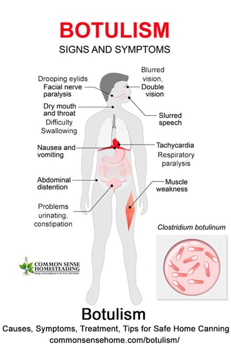 Botulism & Canning Foods: What We All Need To Know - Page 2 of 2 - D.I ...