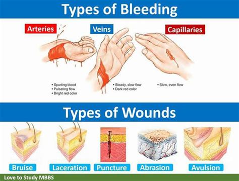 Types of wound - MEDizzy