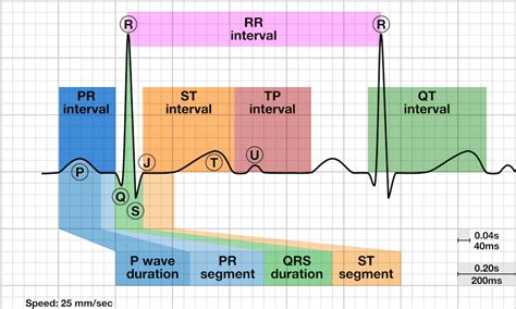 ECG waves segments and intervals LITFL ECG library 3 Qrs Complex ...