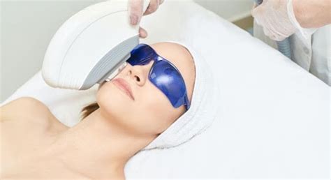 Virginia Beach IPL Rosacea and Acne Treatment