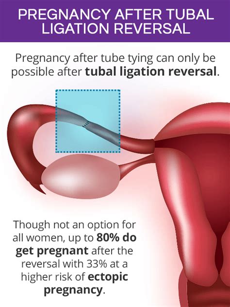 Chances of Getting Pregnant after Tubal Ligation | SheCares