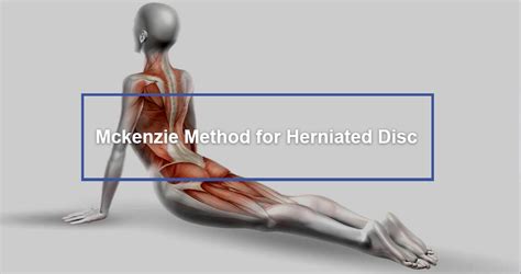 Mckenzie Method for Herniated Disc - Dr. Kevin Pauza, The Discseel® Procedure inventor